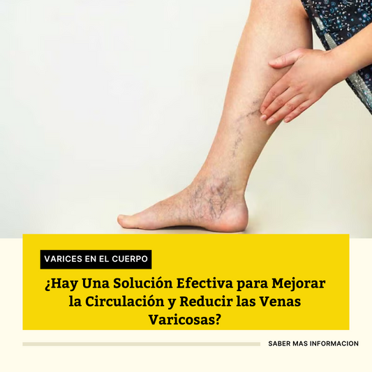 Varicose VEINS ¿Realmente son efectivos? Una Solución Efectiva para Mejorar la Circulación y Reducir las Venas Varicosas